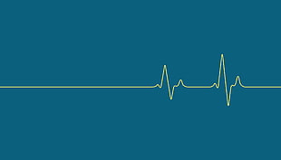 heart rate illustration, digital art, minimalism, simple background, heartbeat