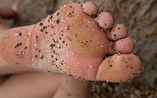 foot with pebbles