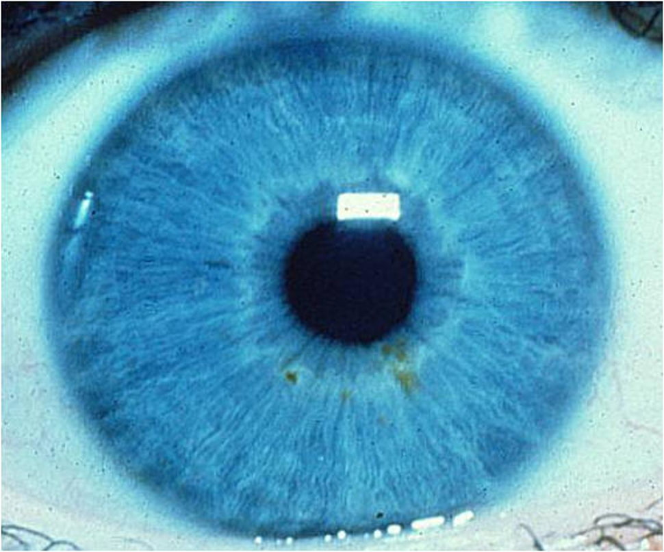 blue eye contact lens HD wallpaper