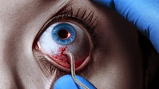 worm coming out of human's eyeball