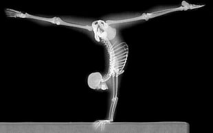 human skeleton, x-rays, gymnastics, bones, handstand