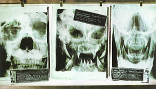 X-Ray result