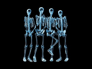 silver-colored beaded hook earrings, x-rays, skeleton