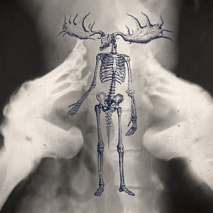 skeleton illustration, drawing, x-rays, ambient, bones HD wallpaper